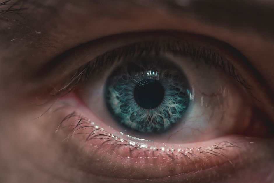Posterior vitreous detachment anatomy